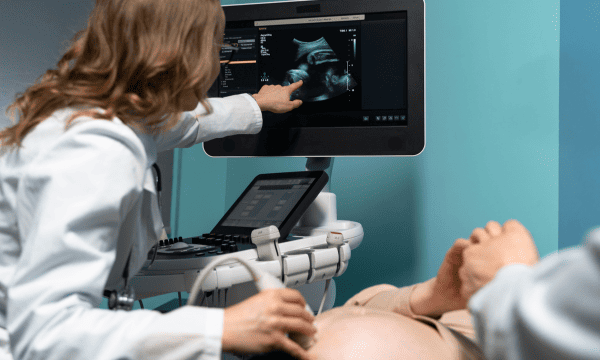 Colour Doppler Studies