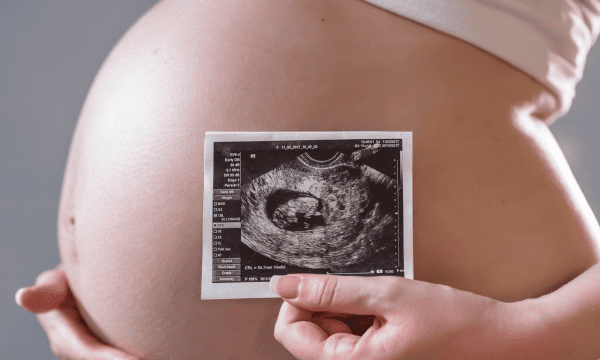 Fetal Imaging Services